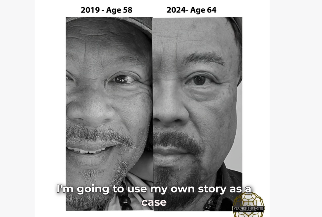 My Medical Records Show Age Reversal - Here is proof!!!
